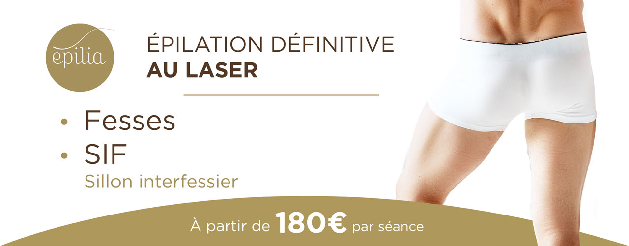 epilation-laser-femmes-sif-homme-wemmel