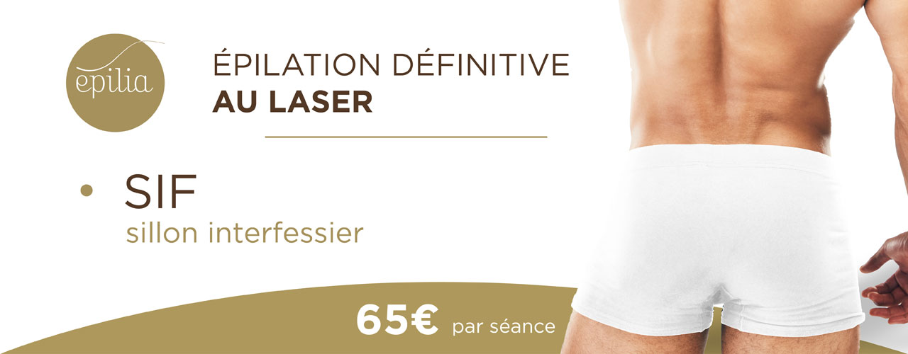 epilation-laser-sif-homme-wemmel