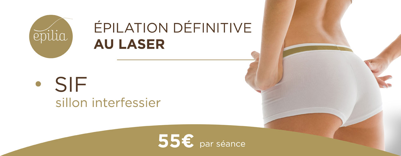 epilation-laser-sif-wemmel