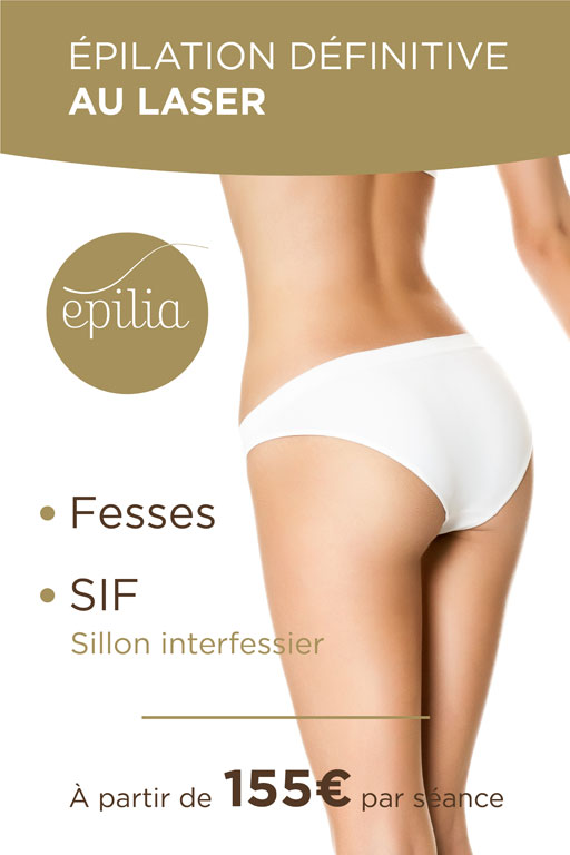 epilation-laser-fesses-sif-wemmel-mob