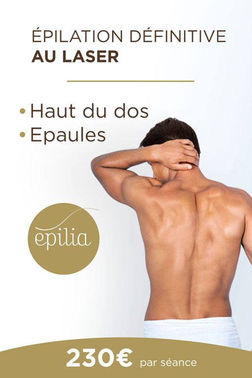 epilation-laser-haut-dos-epaules-wemmel-mob